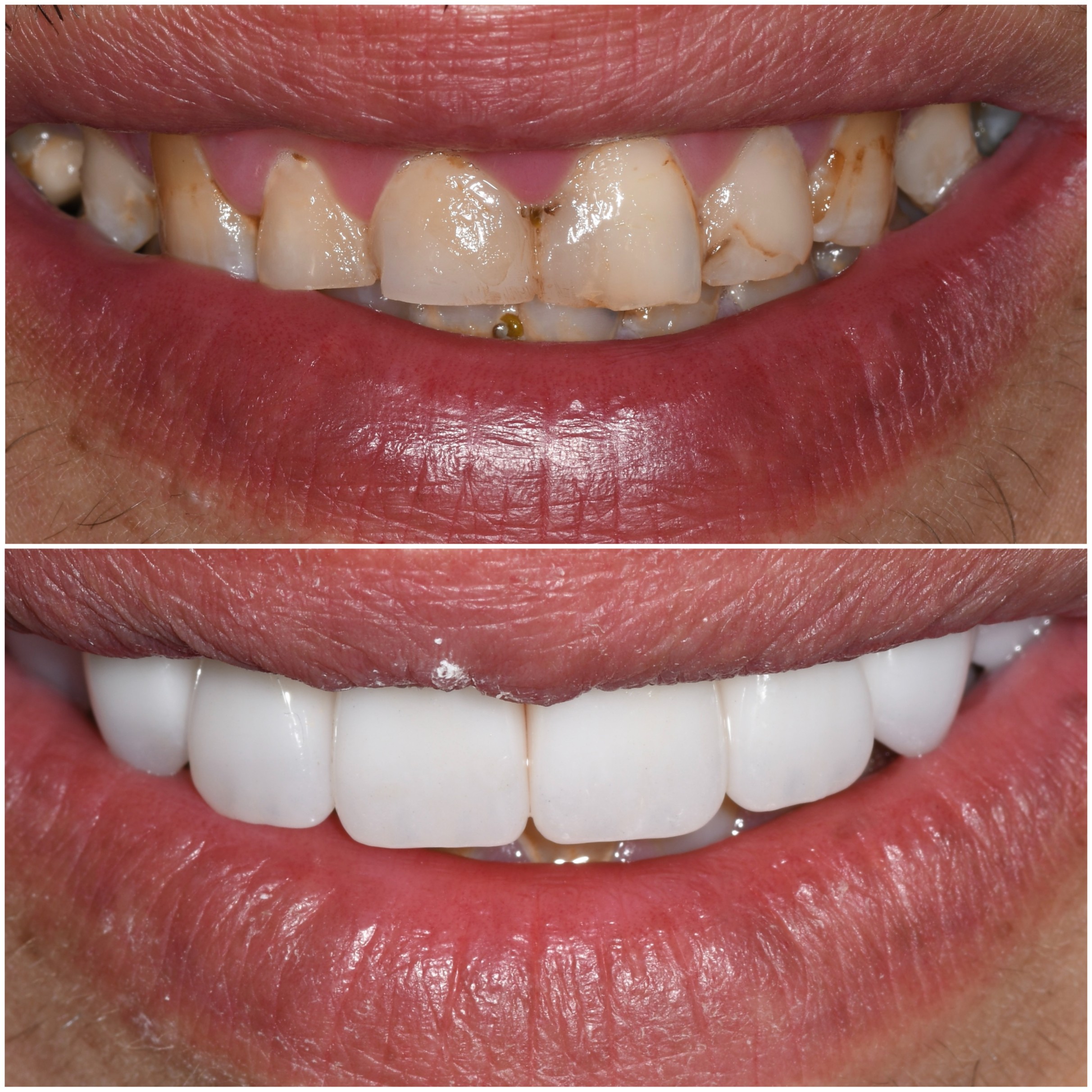 Χαρούμενος ασθενής